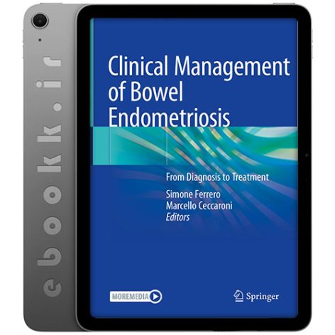 دانلود کتاب Clinical Management of Bowel Endometriosis 2020 به زبان انگلیسی
